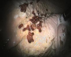 Bot larvae in the stomach